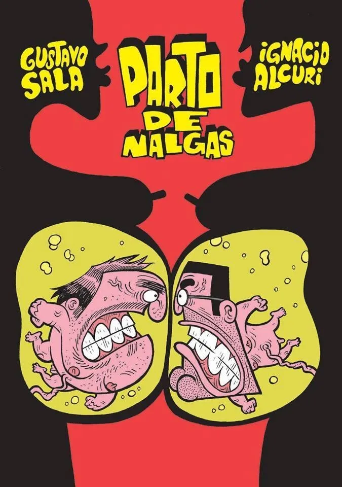 Parto de nalgas